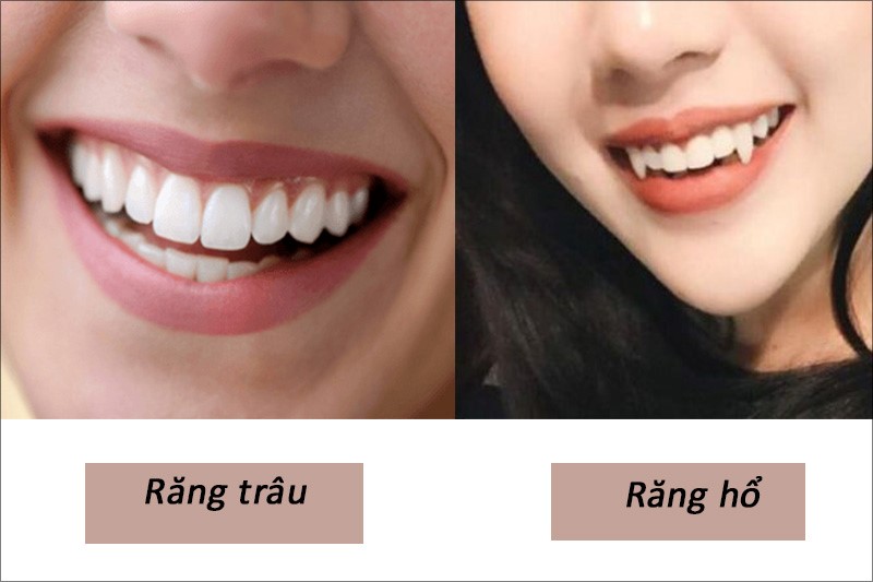 xem-tuong-rang-phong-thuy-4