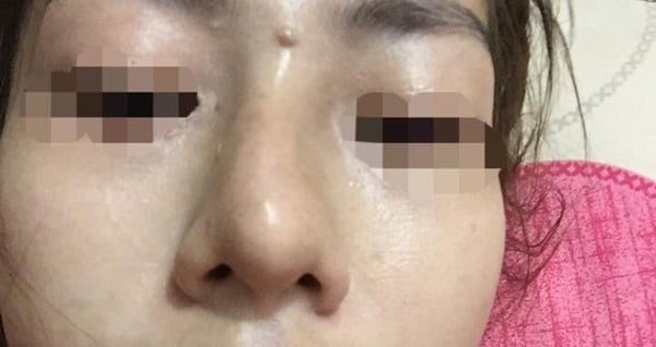 Khi nhìn trong gương thấy mũi khác bình thường thì cũng nên cẩn trọng. 