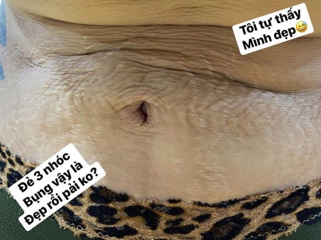 my-nhan-viet-can-dam-khoe-chien-tich-sau-sinh-a99c11