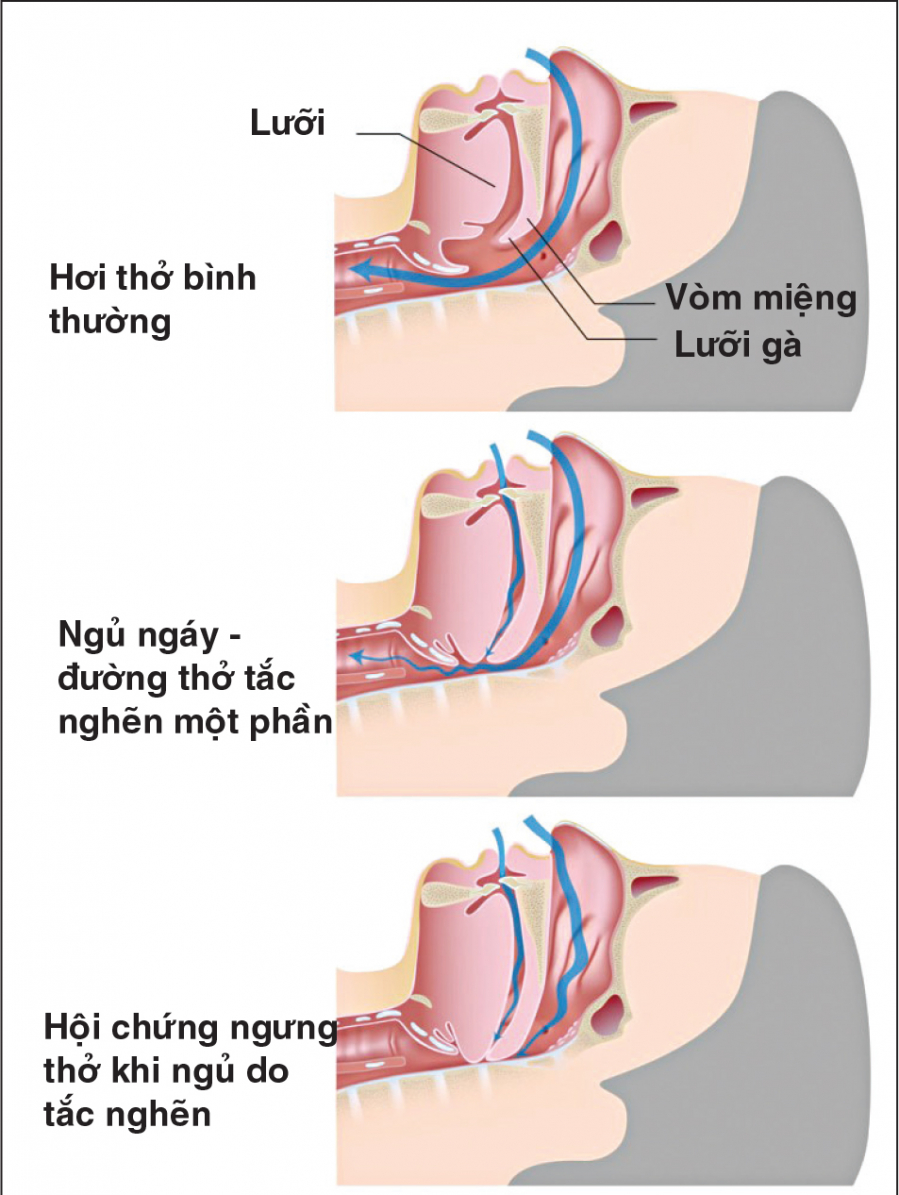 thanh-nien-29t-ngung-tho-roi-ra-di-ngay-trong-luc-ngu-02