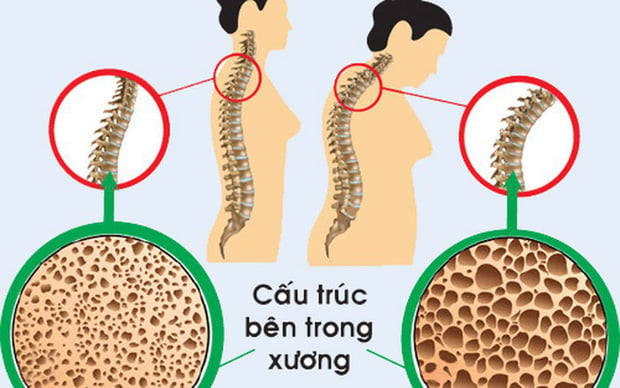 loang-xuong-a1-60289-15229275703461223394439
