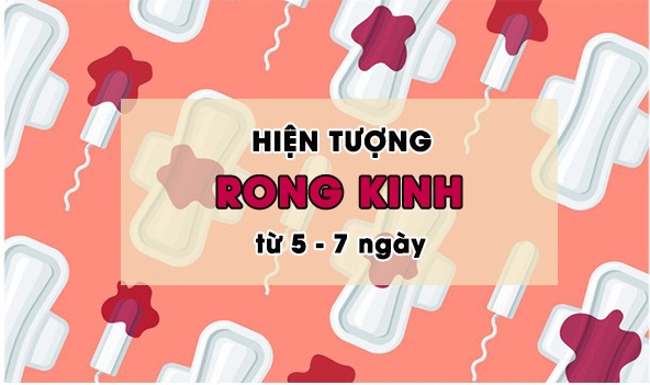 rong-kinh-la-gi