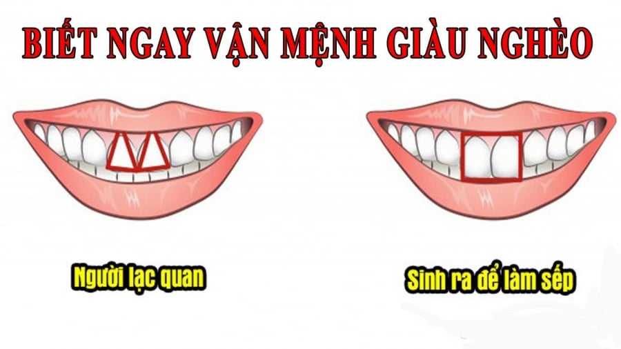 tuong rang