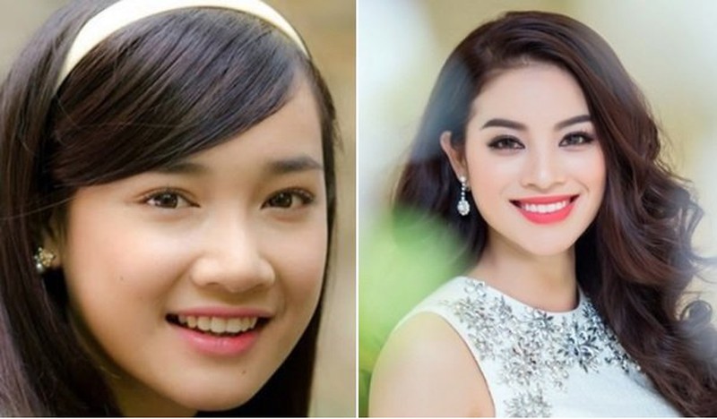 Ai sở hữu chiếc mũi to thì xác định công danh rực rỡ, tiền tiêu không hết chớ dại mà xóa đi.