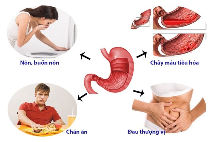 Những biểu hiện bất thường khi bị đau Shbet123 Link Vào ShBet Mới Nhất dễ nguy hiểm đến tính mạng.
