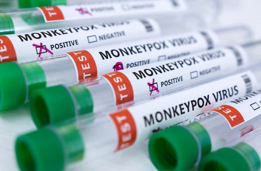 Tìm thấy mảnh ADN của virus gây bệnh đậu mùa khỉ trong tinh dịch nam giới.   