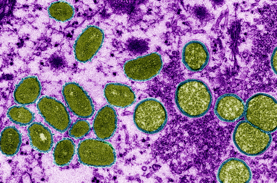 Virus đậu mùa khỉ - Ảnh: CDC/SCIENCE  