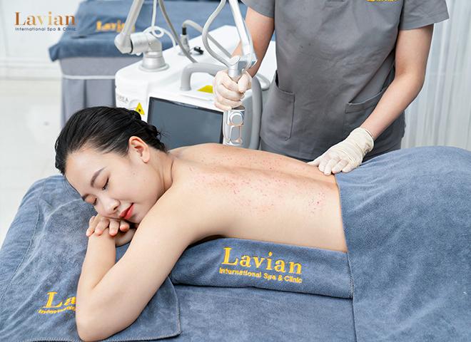 Lavian sử dụng máy móc công nghệ cao xử lý vấn đề sắc tố da
