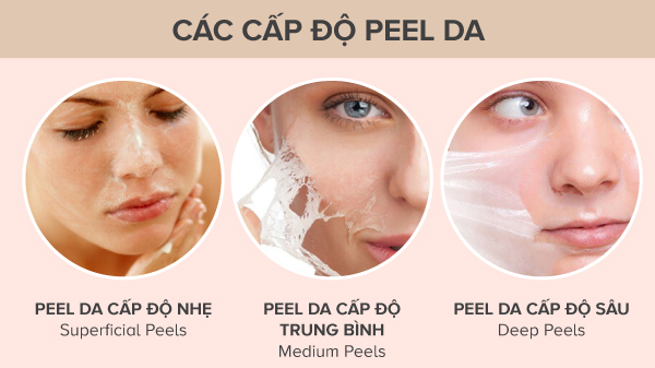 cac-buoc-cham-soc-da-sau-peel-chuan-y-khoa-1