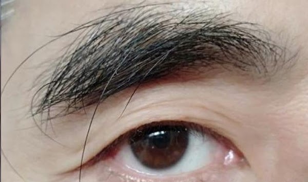 longmoc