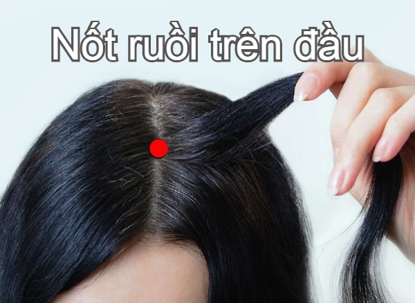 not-ruoi-01