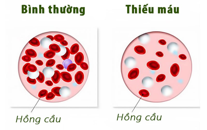 20200917_thieu-mau