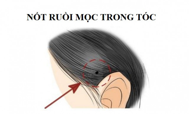 not-ruoi-tai-loc-03
