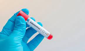 adenovirus1