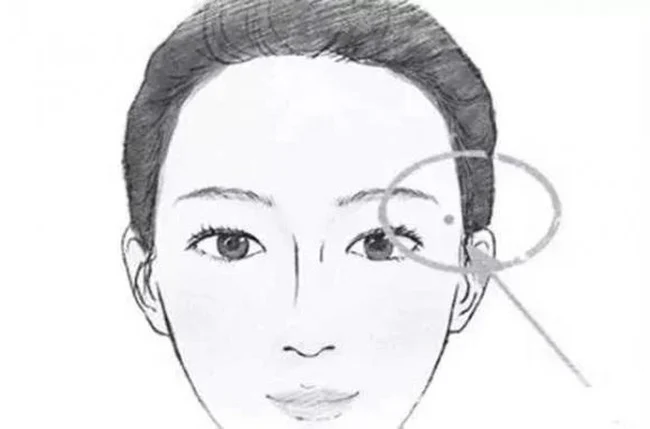 xem-tuong-not-ruoi