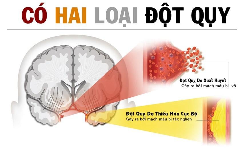 thay-3-dau-hieu-dot-quy-nay-can-so-cuuc-ngya-de-khong-bo-lo-thoi-gian-vang-6