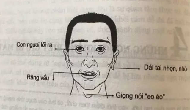 (ảnh minh họa)