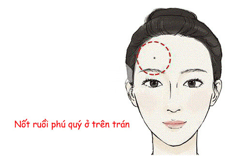 not-ruoi-tai-loc-vi-tri-2