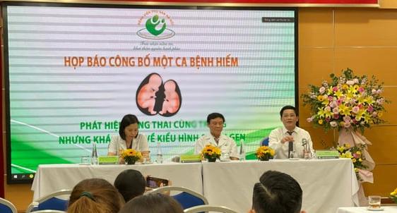Bệnh viện Phụ sản Hà Nội công bố ca hiếm song thai cùng trứng khác kiểu hình, kiểu gene - Ảnh: D.LIỄU