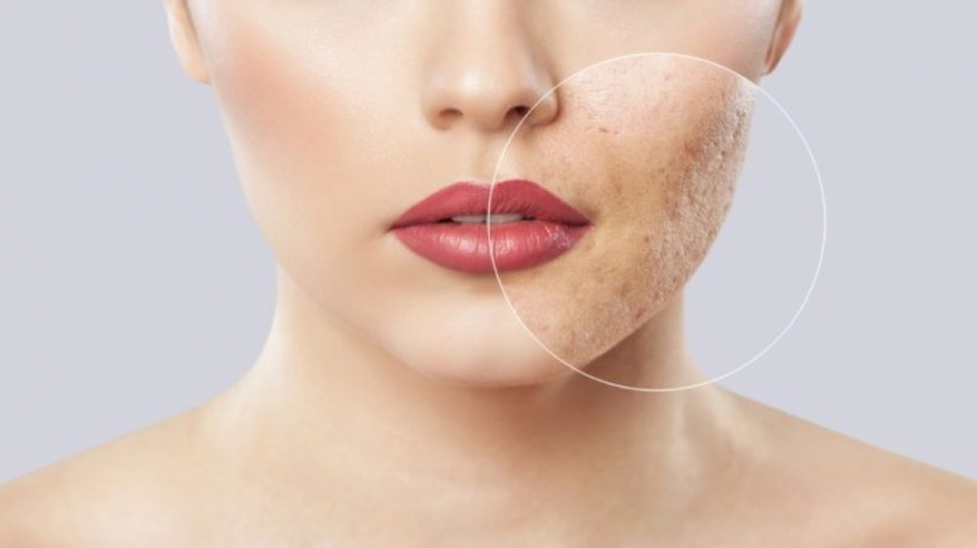 minhkhuecosmetics.vn_20210609_153435_840521_da-xin-mau-thieu-suc-.max-800x800-1