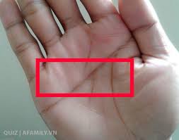 images (11)