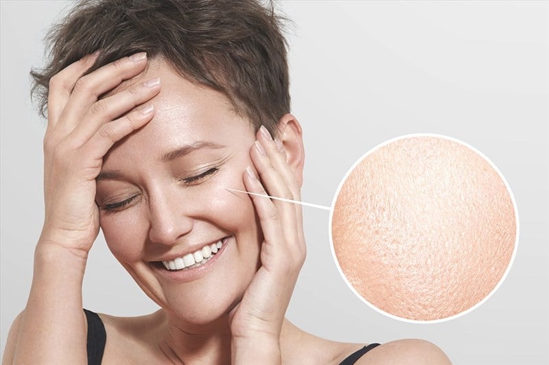 Enlarged-Facial-Pore