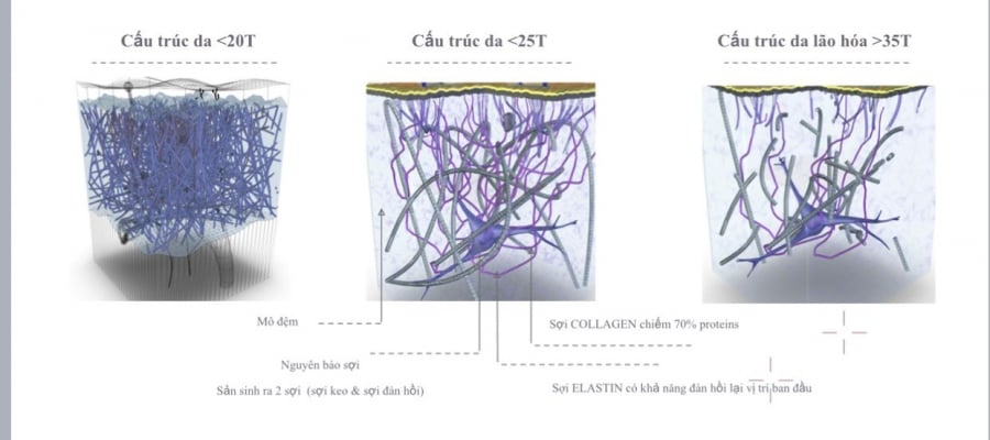 Sau độ tuổi 30, sợi Collagen và Elastin bị suy giảm dẫn tới hiện tượng lão hóa trên da