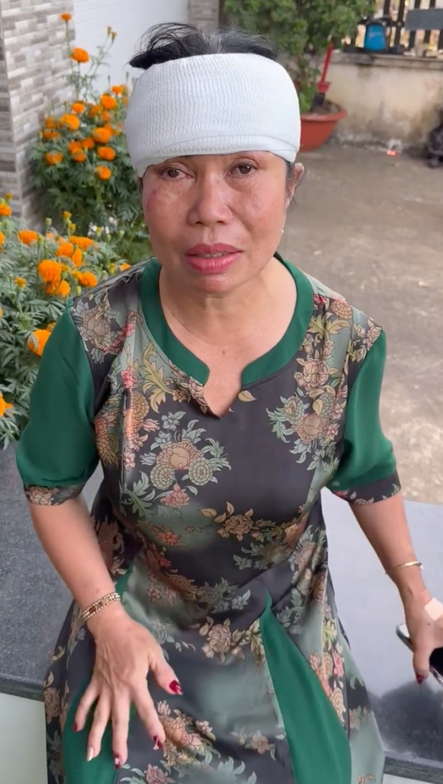 me-duong-lam-gap-su-co-ngay-mung-2-tet-ra-gieng-tiep-tuc-di-kham-4bb33cad