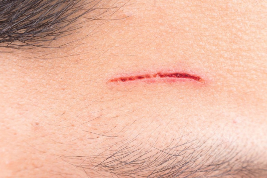 cut_5