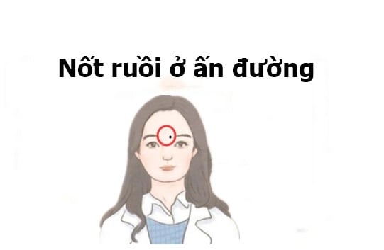 xem-tuong-not-ruoi-xau-04