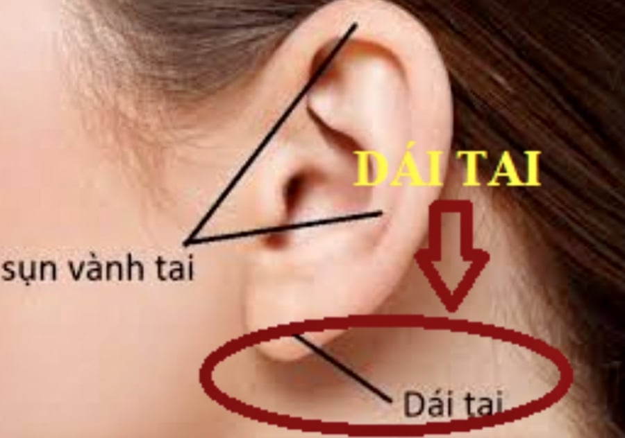 dai_tai_bi_sung_1