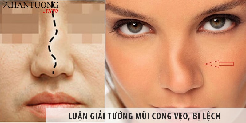 luan-giai-tuong-mui-cong-veo-bi-lech