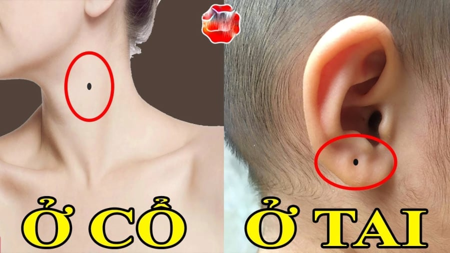 xem-not-ruoi