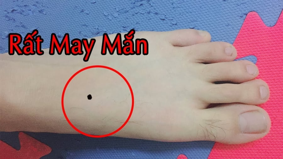 xem-not-ruoi-may-man