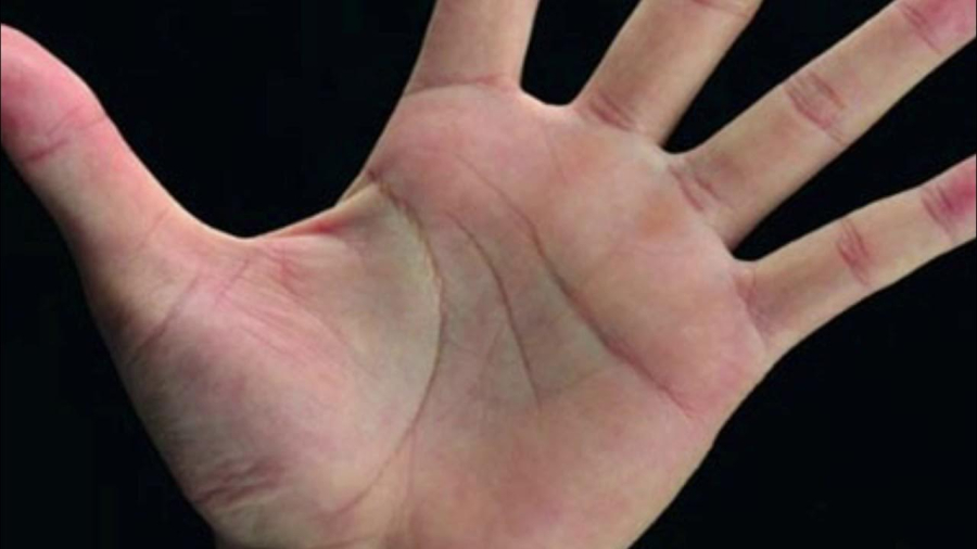 19
