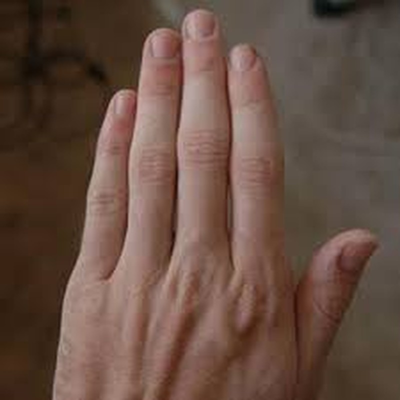 32