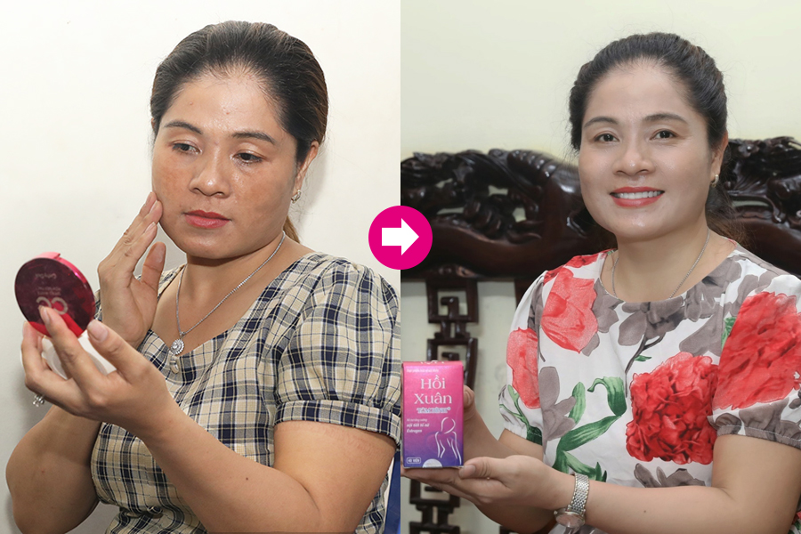 Sau 3 tháng sử dụng Hồi xuân Tâm Bình, chị Lý đã lấy lại sự tự tin với Mừng SHBET phiên bản mới 2025 sáng khỏe, các triệu chứng khó chịu cũng được cải thiện rõ rệt