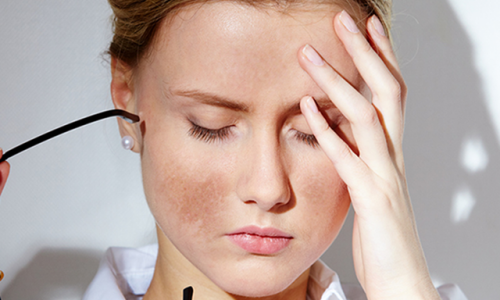 file-sua-melasma-pr-dantridocx-1556769025916-500x300