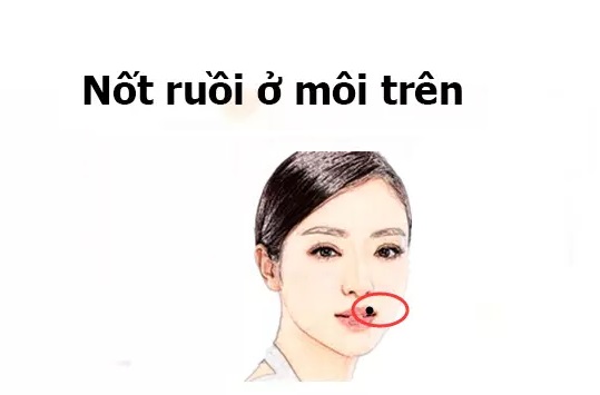 not-ruoi-tai-loc-06