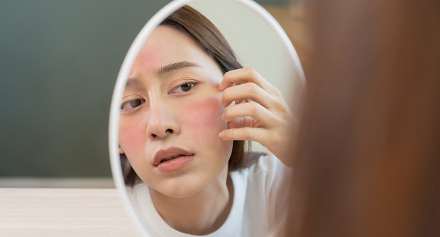 Khi da liên tục phản ứng với môi trường hay mỹ phẩm, hãy cẩn thận, đây là biểu hiện của Mừng SHBET phiên bản mới 2025  nhạy cảm.