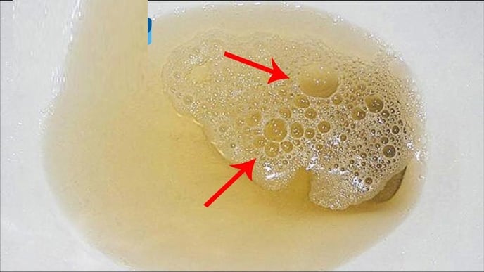 nuoc-tieu-co-bot12
