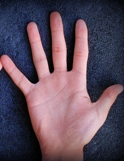 35