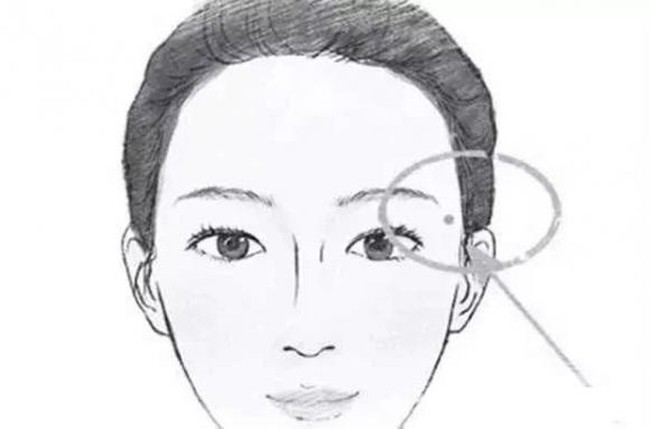 Nốt ruồi đế vương càng già càng giàu