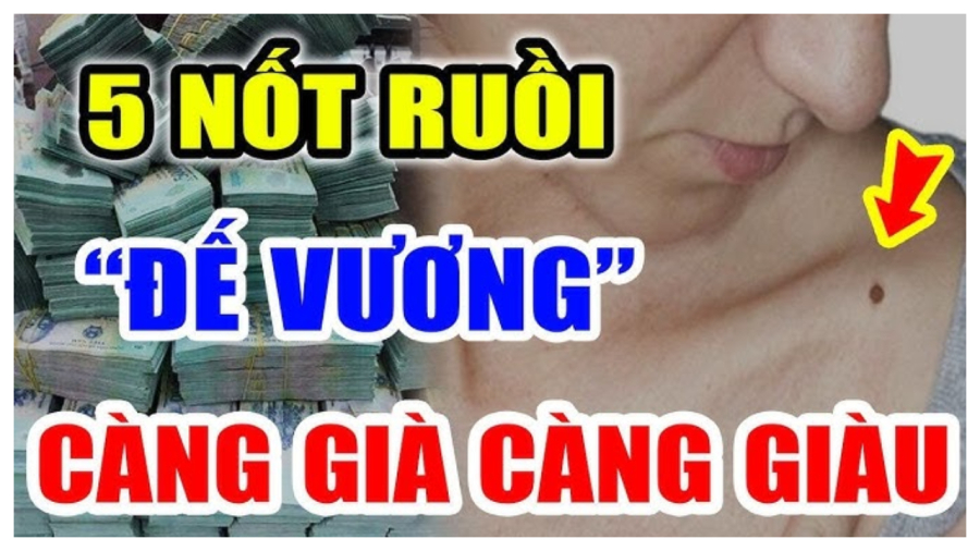 Vị trí nốt ruồi may mắn