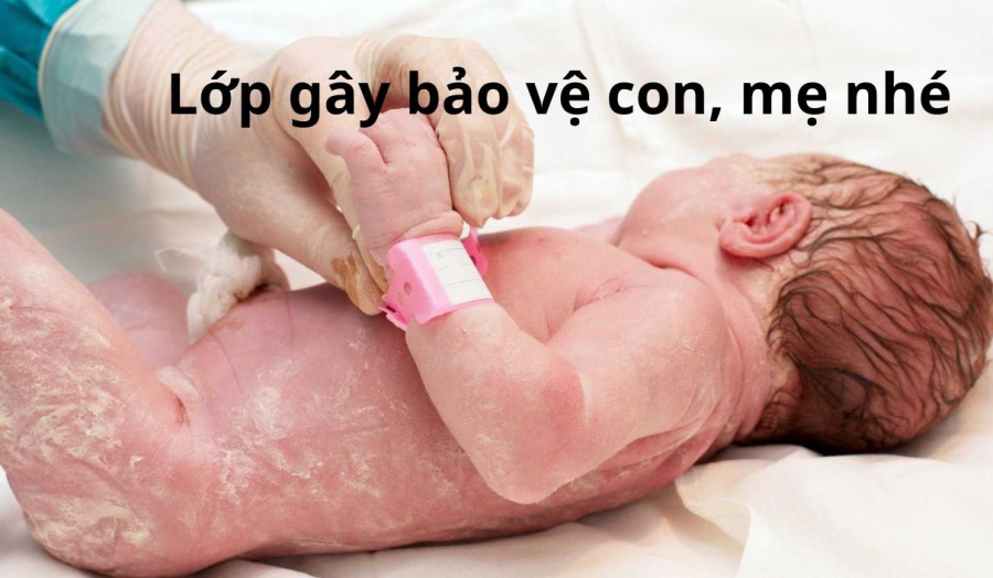 bao ve chat gay