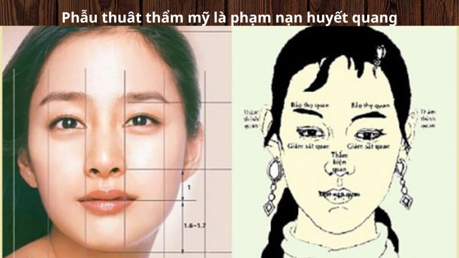 tham my sua tuong