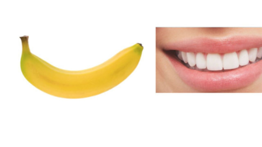 chuoi