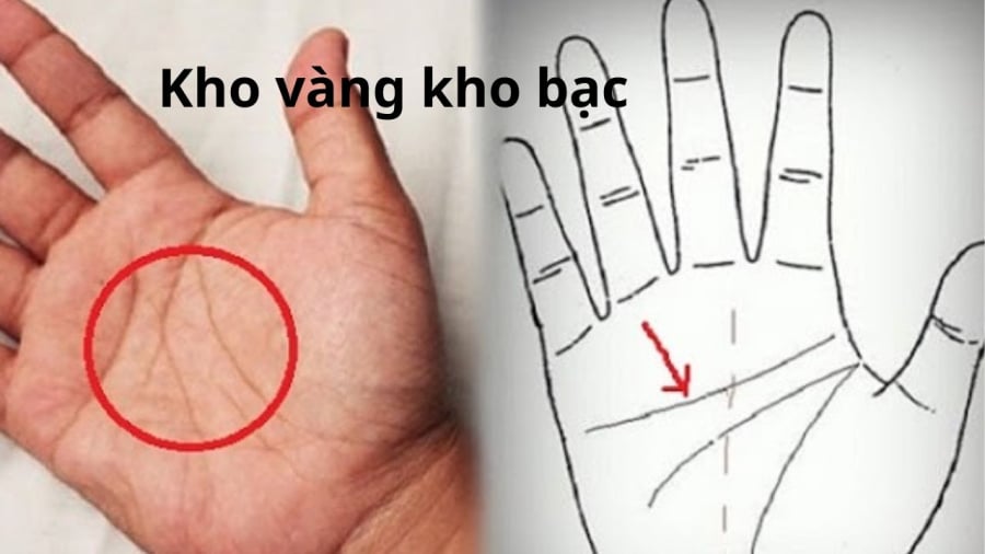 van tay song song