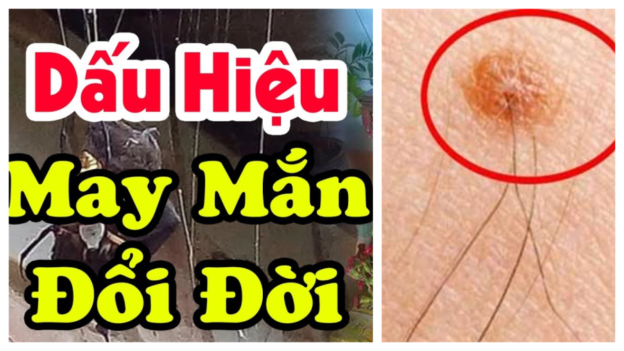 long-moc-cho-nay-may-man