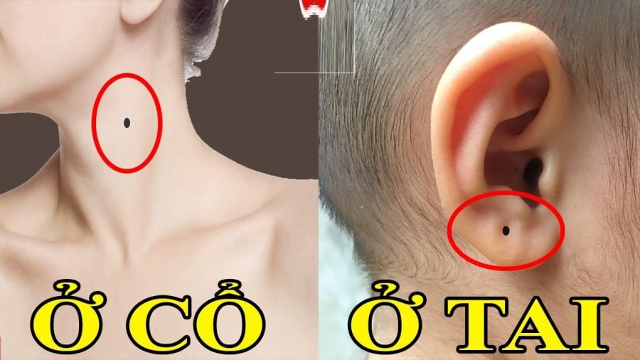 xem-not-ruoi